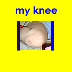 Hannah Sassaman's knee